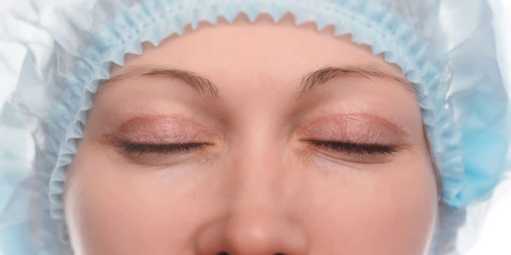 Chirurgie des paupières marseille Dr Pelletier