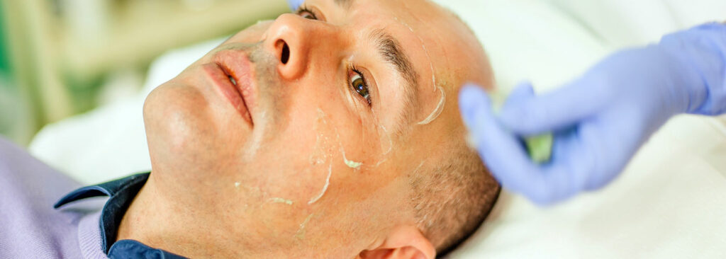 peeling homme marseille aubagne