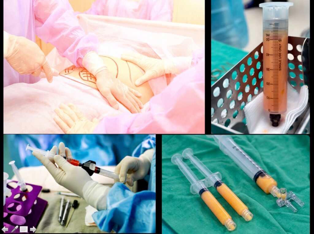 lipostructure-aubagne